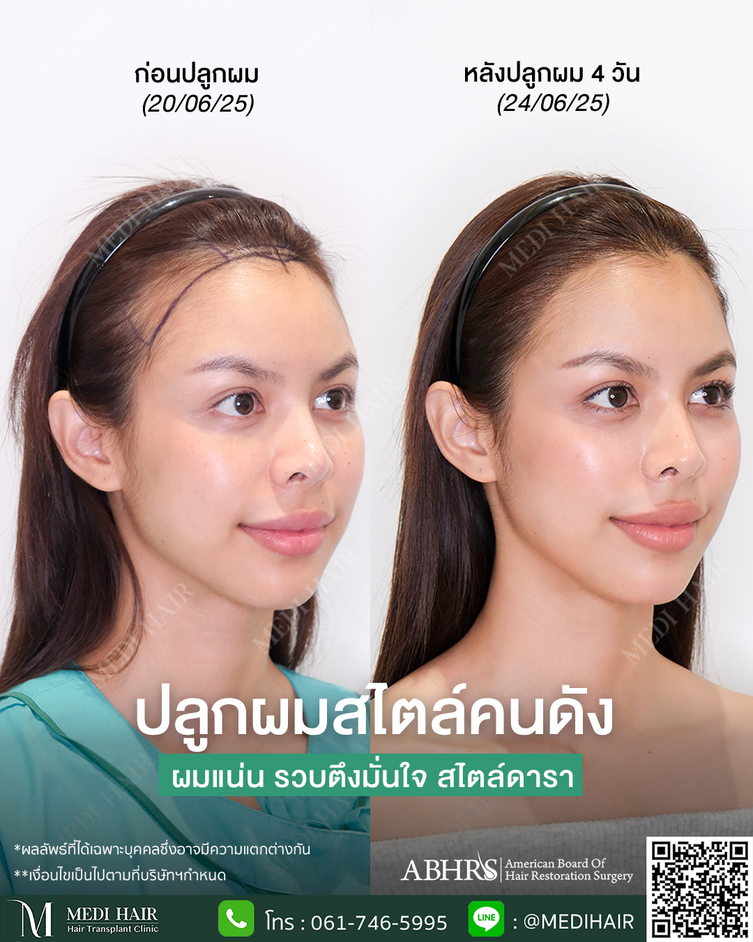 MEDI HAIR Facebook ad