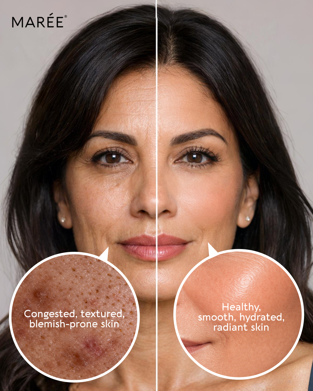 Marée USA Facebook ad: Professional Skin Reset, At Home
