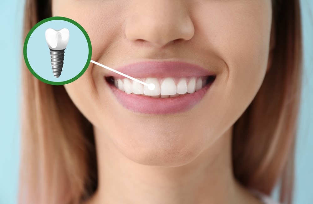 All Smile Care Facebook ad
