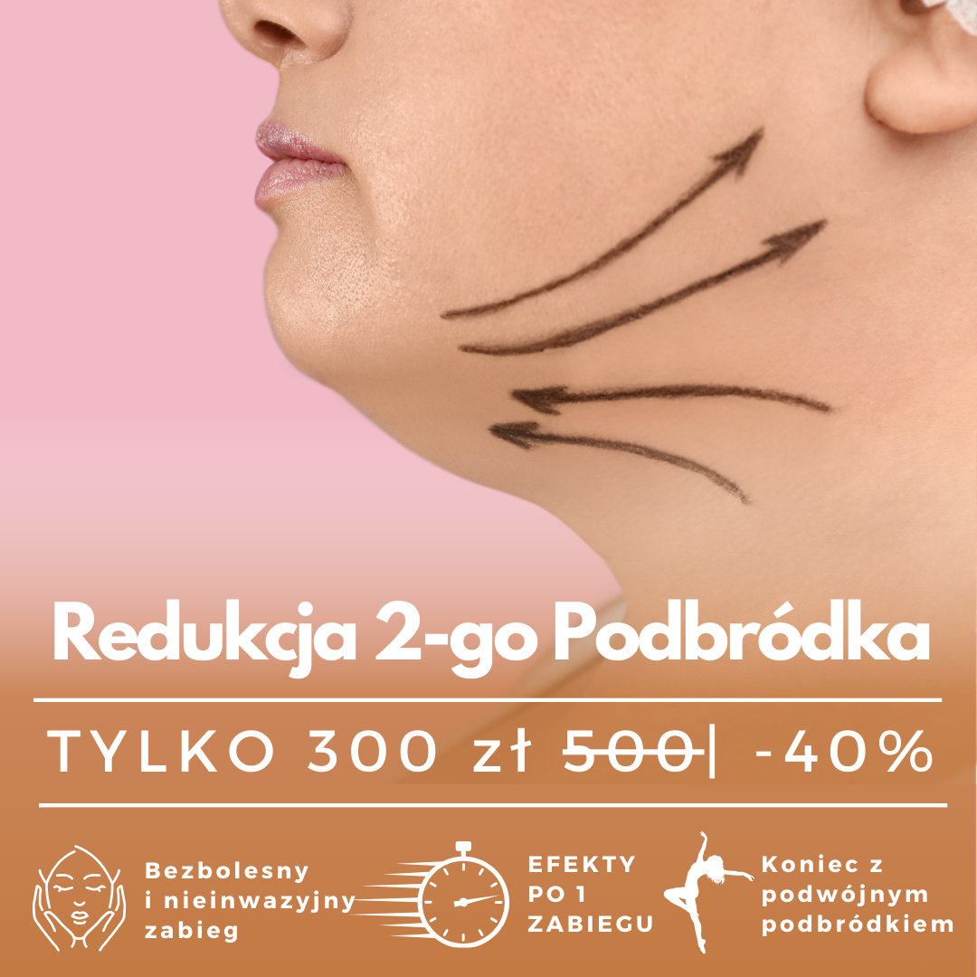 Klinika Urody Ayu Facebook ad