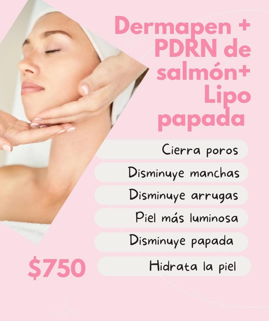 spacio bienestar cosmetología Facebook ad: dermapen + PDRN + lipo papada promoción $750