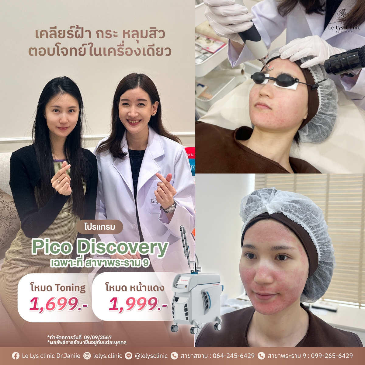 Le Lys clinic by Dr.Janiie เลอลิส คลินิก Facebook ad: โปรแกรม Pico Discovery เป็นโปรแกรมเลเซอร์ที่ดูแลครอบคลุมปัญ…