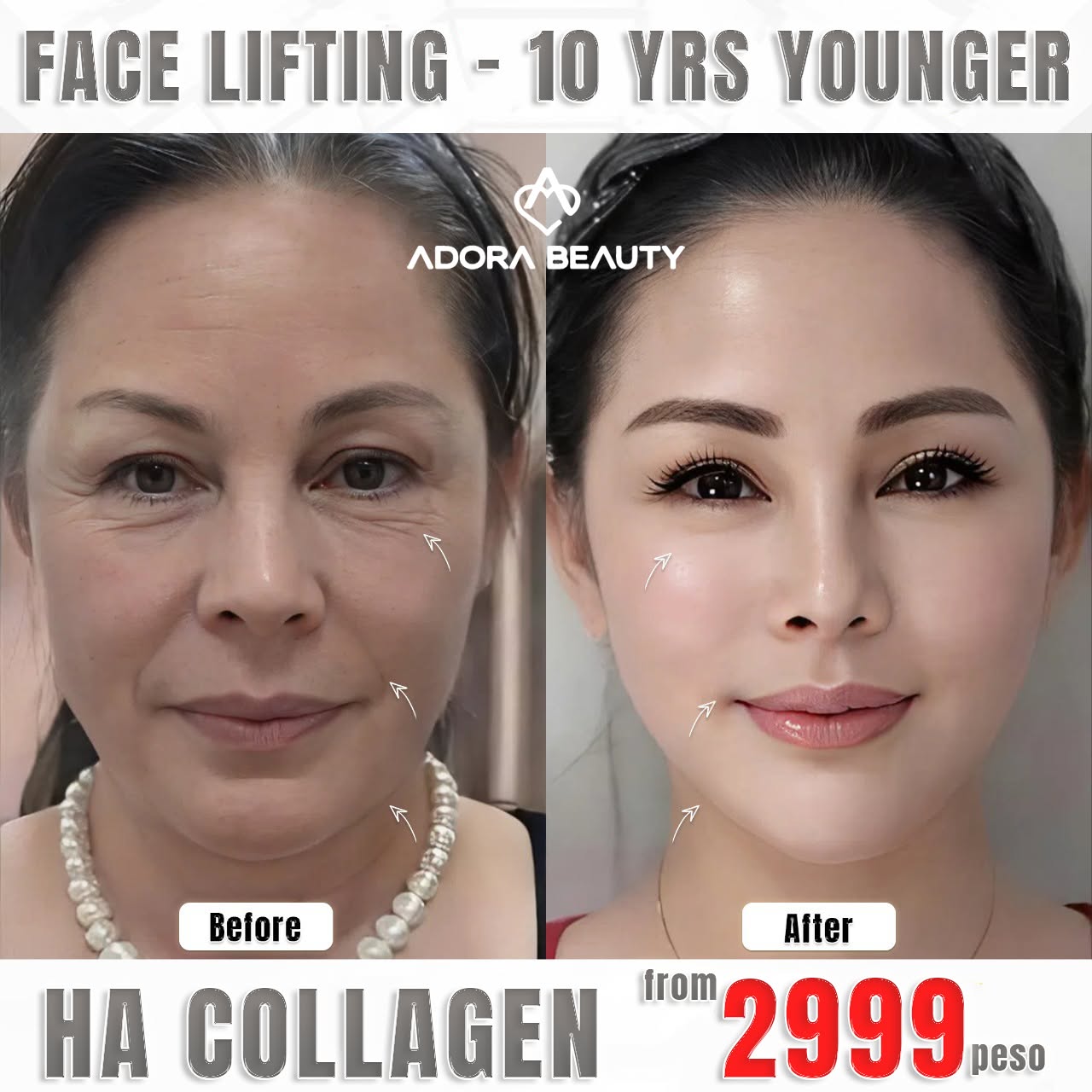 Adora Beauty Center - The Beauty Paradise No.1 in the Philippines Facebook ad: Get a free consultation now!