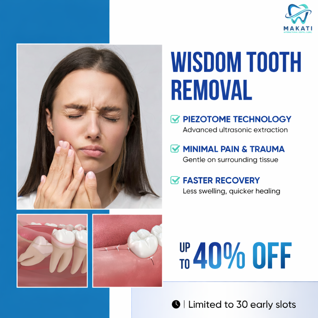 Makati Dental Clinic Facebook ad: Don’t wait until it hurts - Book your FREE consultation…