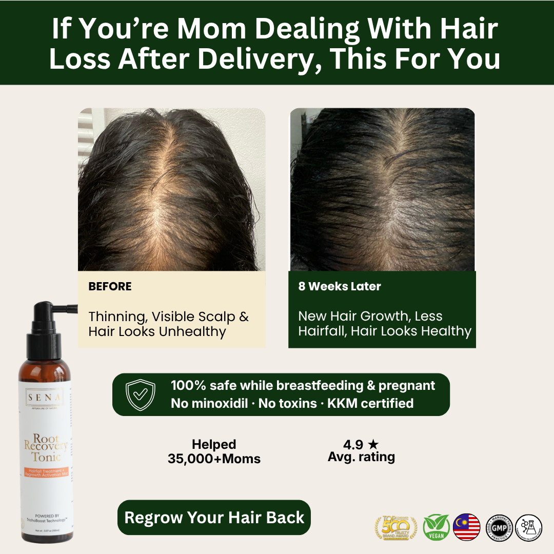 SENA HQ Facebook ad: Postpartum Hair Loss Getting Worse