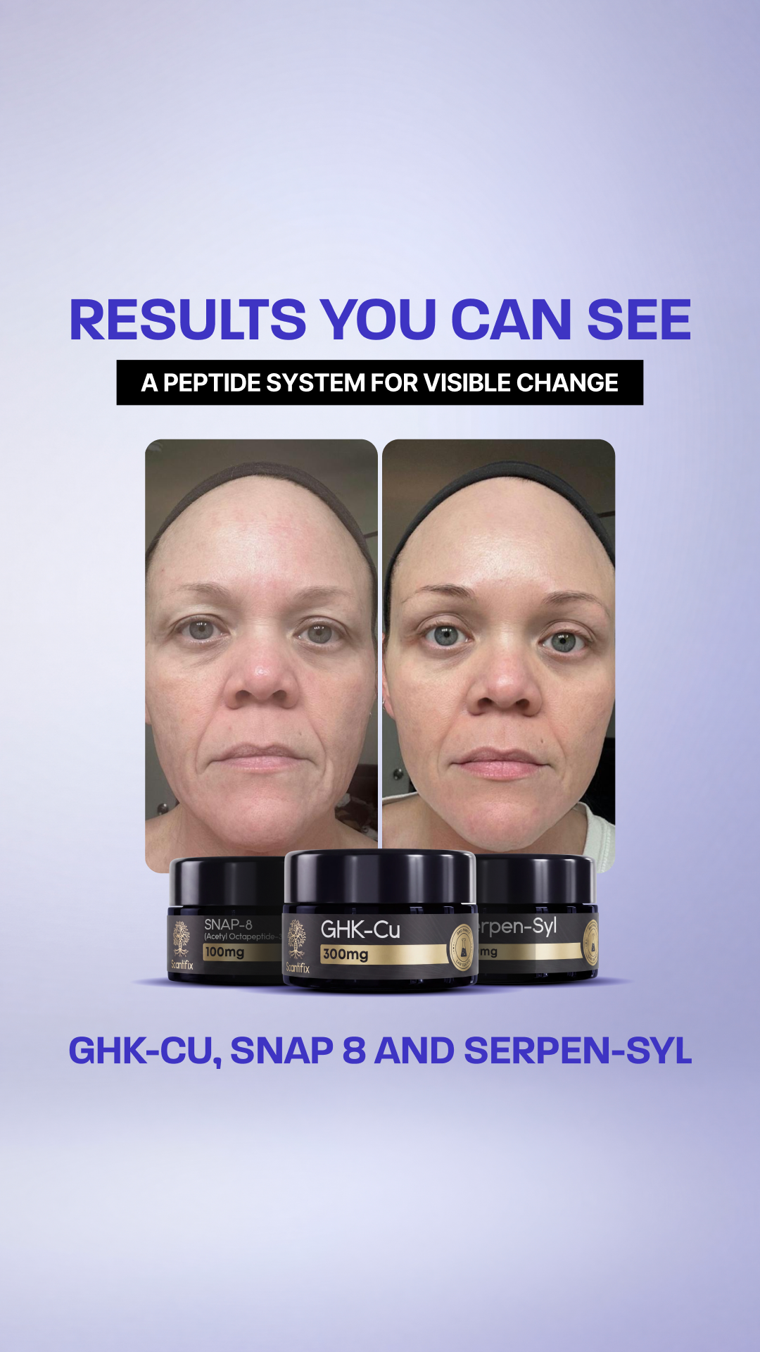 Scantifix Facebook ad