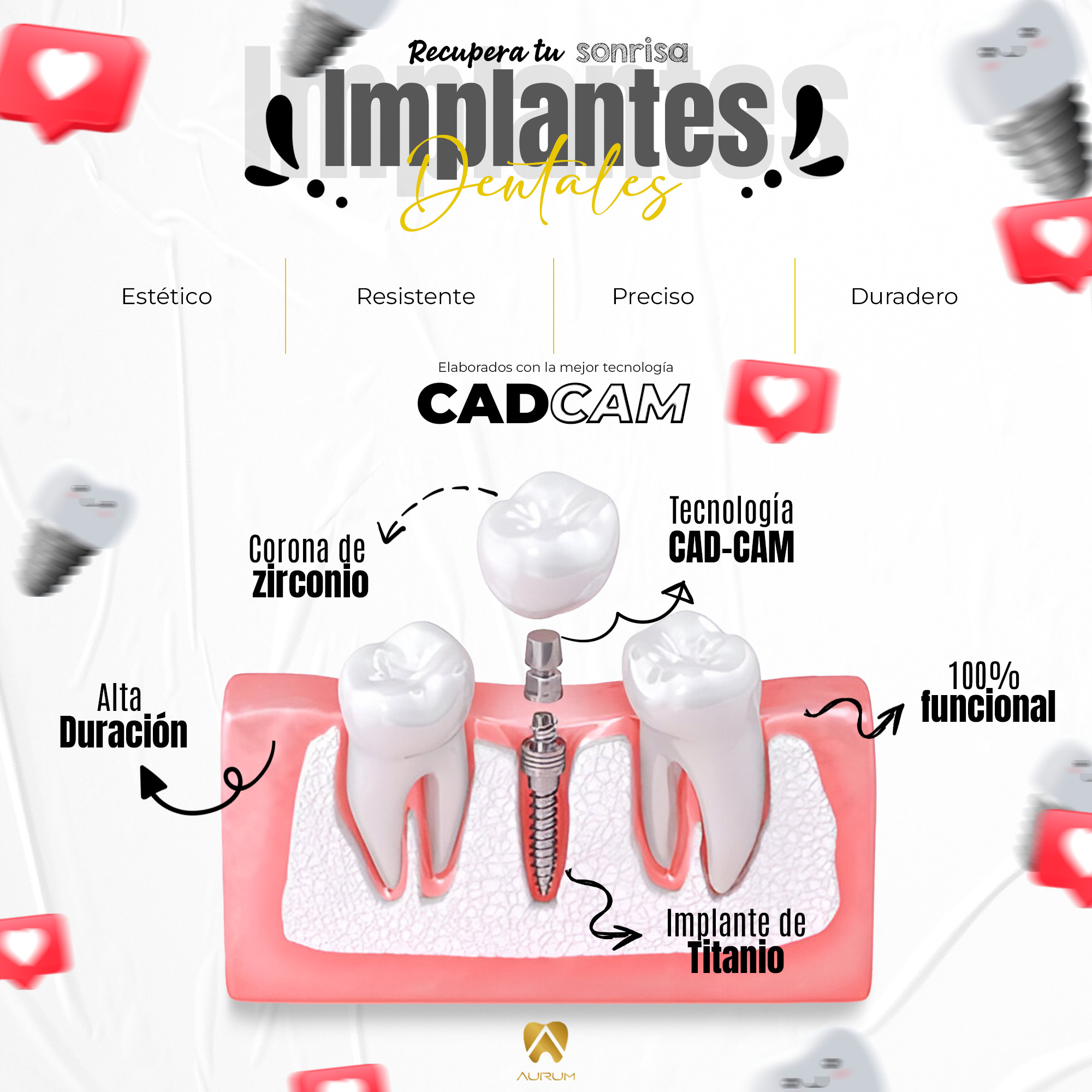 AURUM Estética Dental Facebook ad: Somos expertos en implantes dentales.