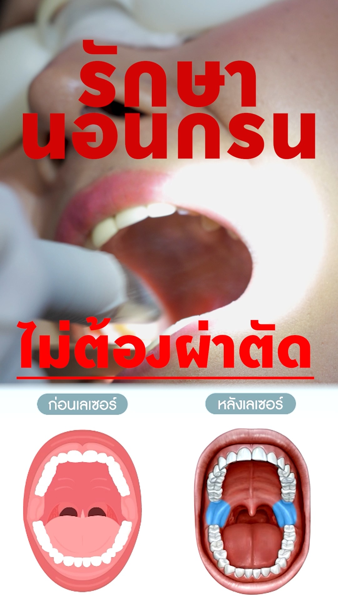 Destiny Clinic Facebook ad: ใครมีเพื่อน พี่ น้อง นอนกรน
