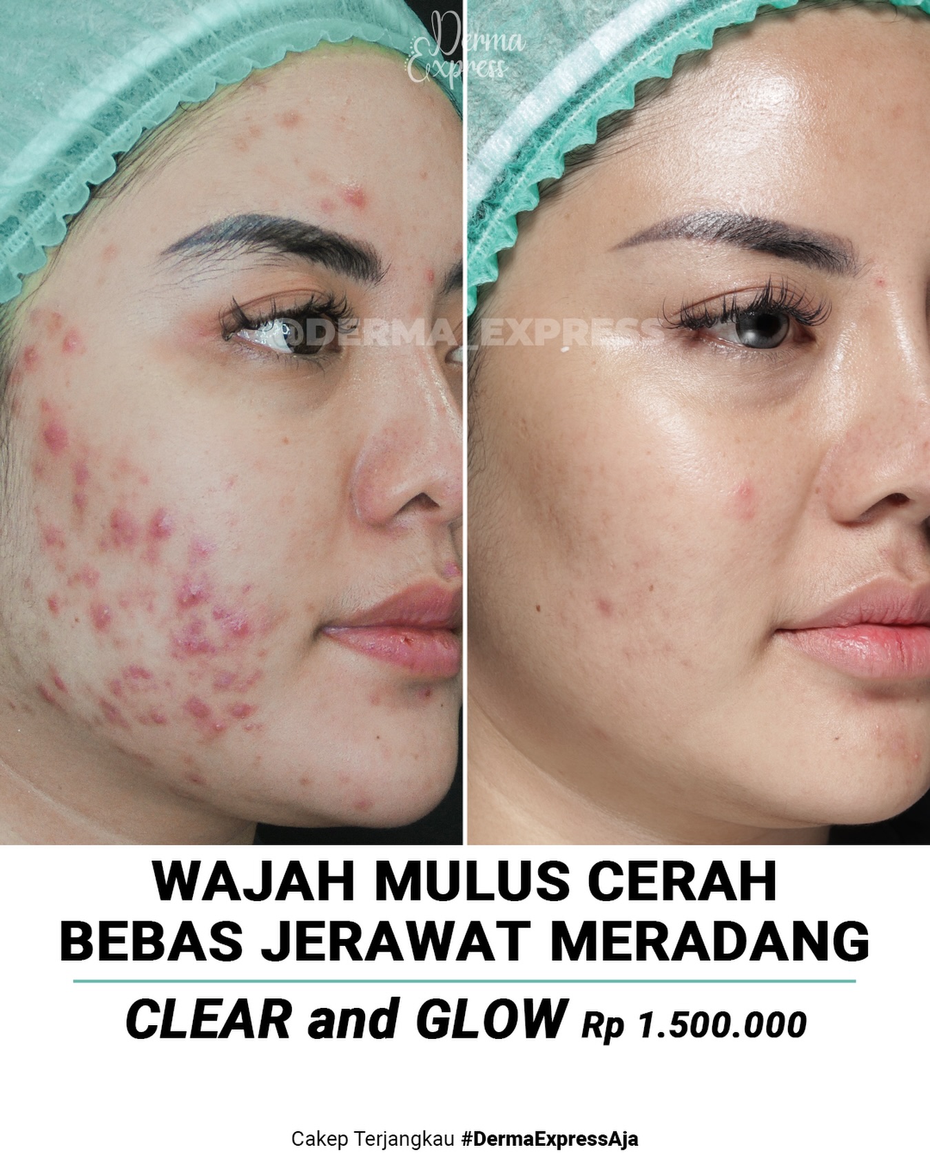 derma_express Facebook ad