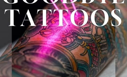 Kplasertattoo Facebook ad