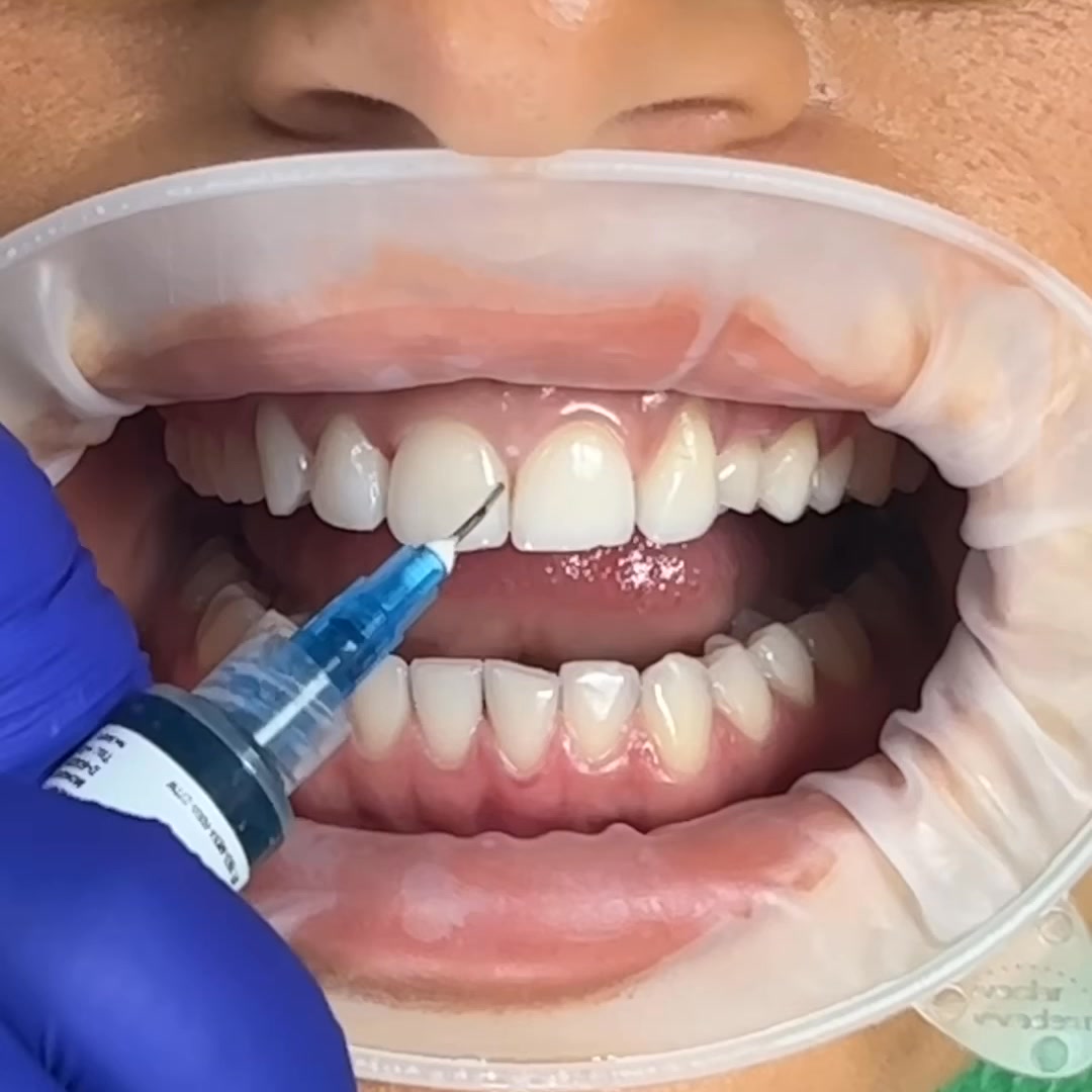 Kissdental Cosmetic Dentistry Facebook ad from May 1, 2026