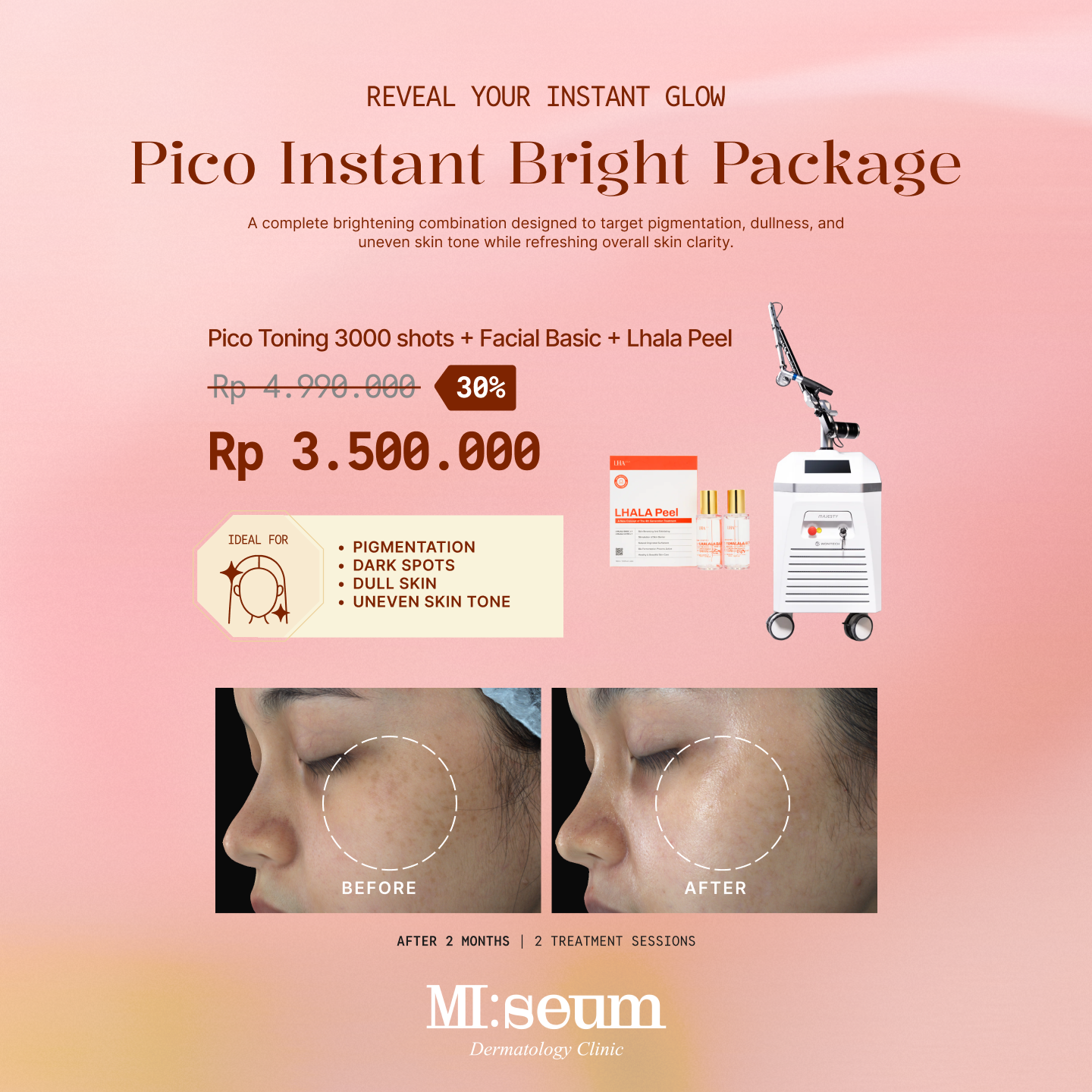 MiseumClinic.id Facebook ad: Wujudkan kulit cerah, glowing, dan bebas noda hitam…