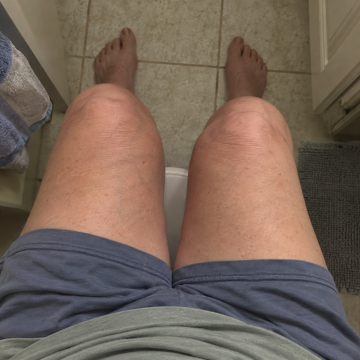 Skin Tips After 40 Facebook ad: I Wasn’t Cold