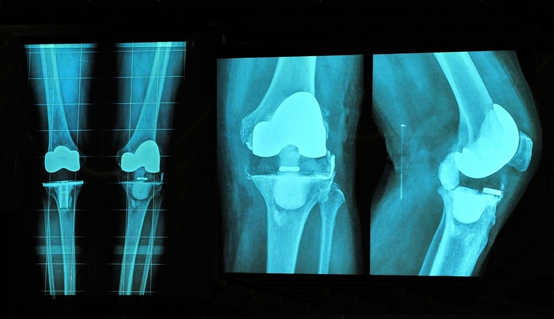 Dr. Eric Schmitt, DC Facebook ad: $49 Knee Pain Relief Package!