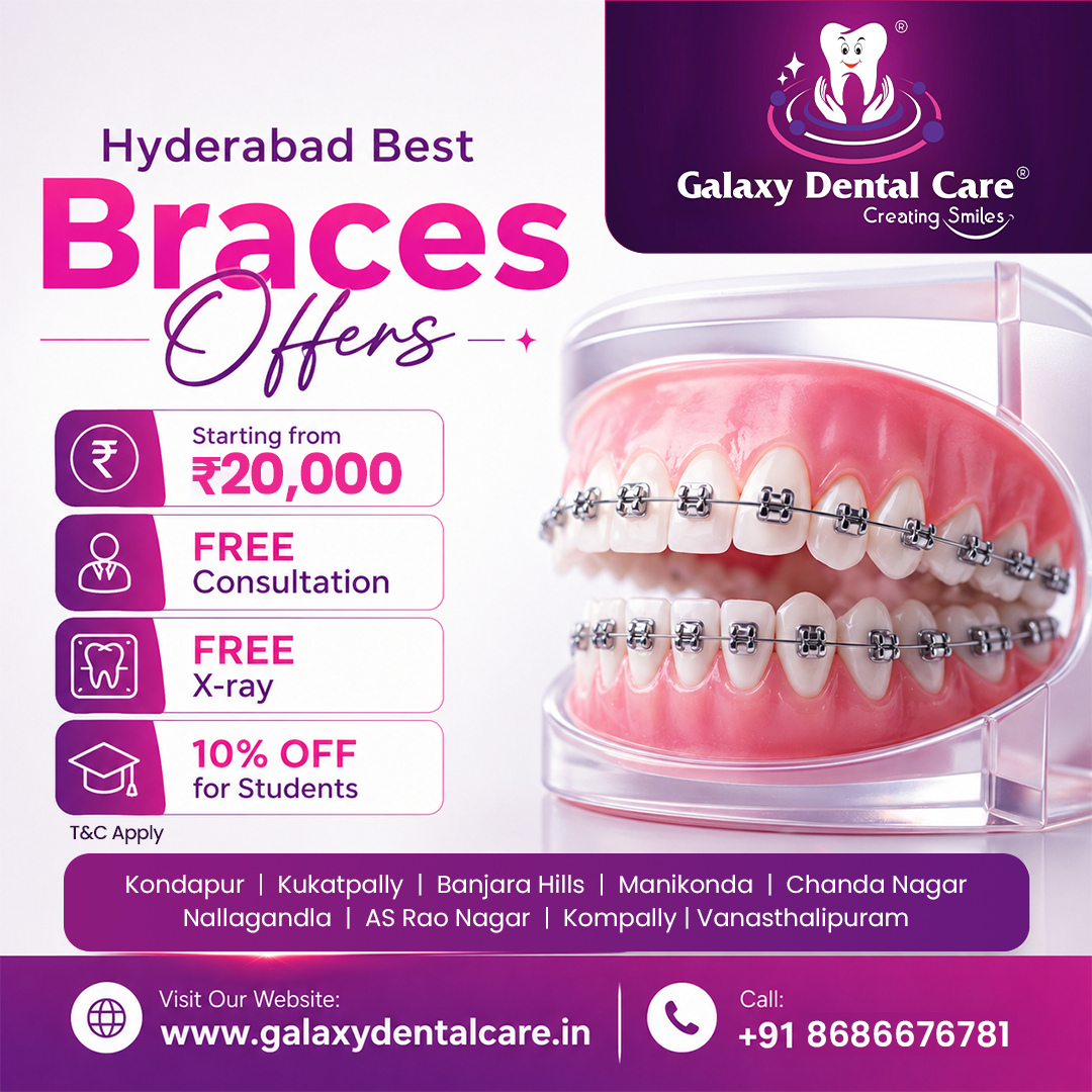 Galaxy Dental Care Facebook ad