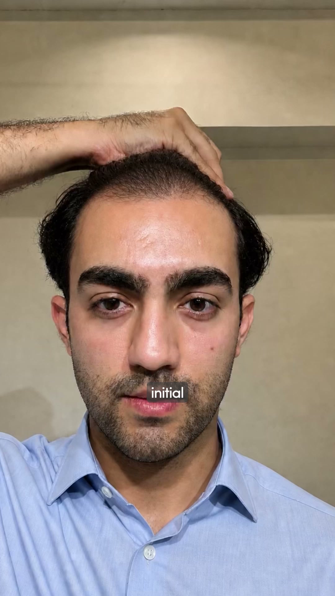 Hair Matters by Man Matters Facebook ad from Aug 3, 2026