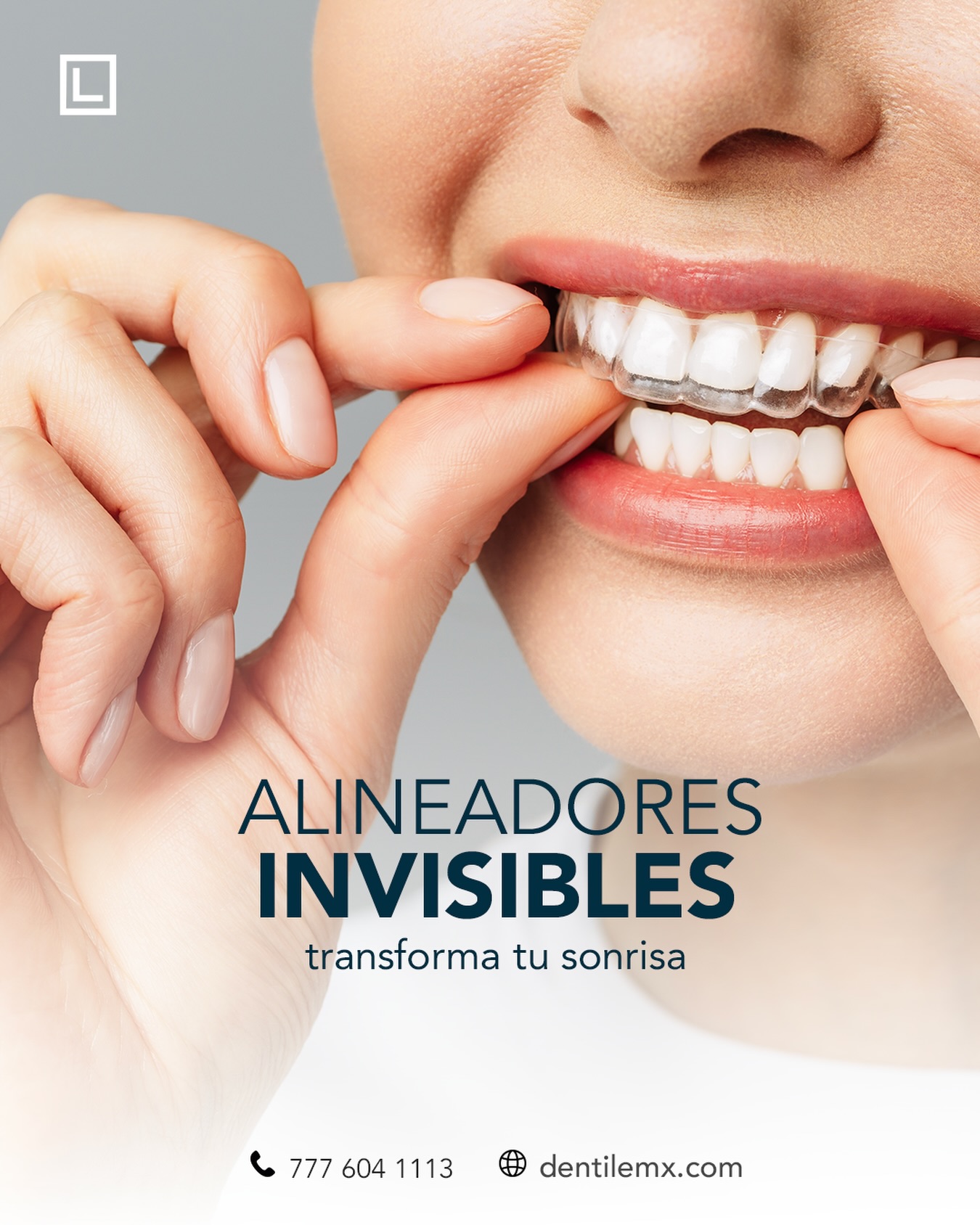 Dentline MX / Clinica de Ortodoncia en Cuernavaca Facebook ad: Corrige tu sonrisa sin que nadie lo note