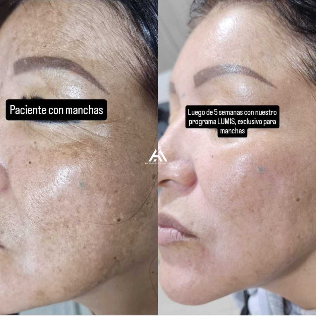 Dr Jorge Asto Dermatología Facebook ad