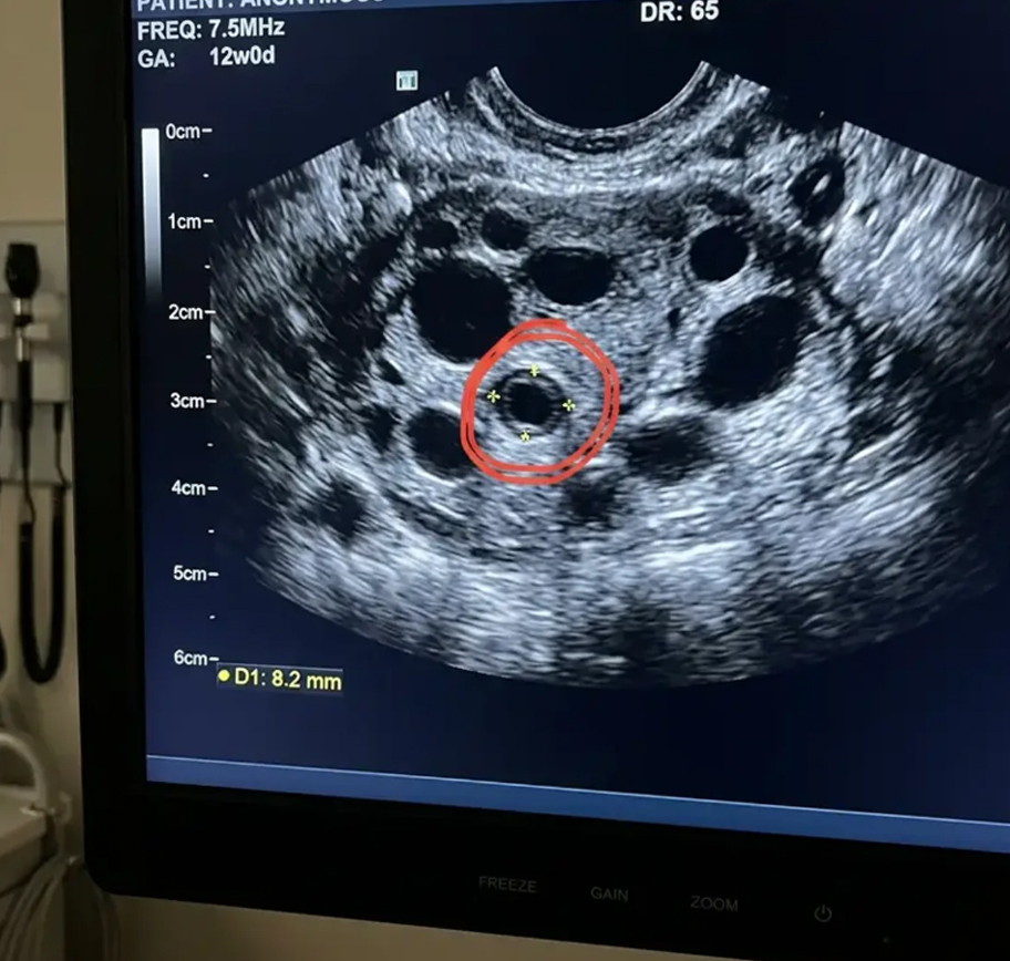 Sarah Mccullough Facebook ad: If Your Fertility Doctor Said Consider Donor Eggs.