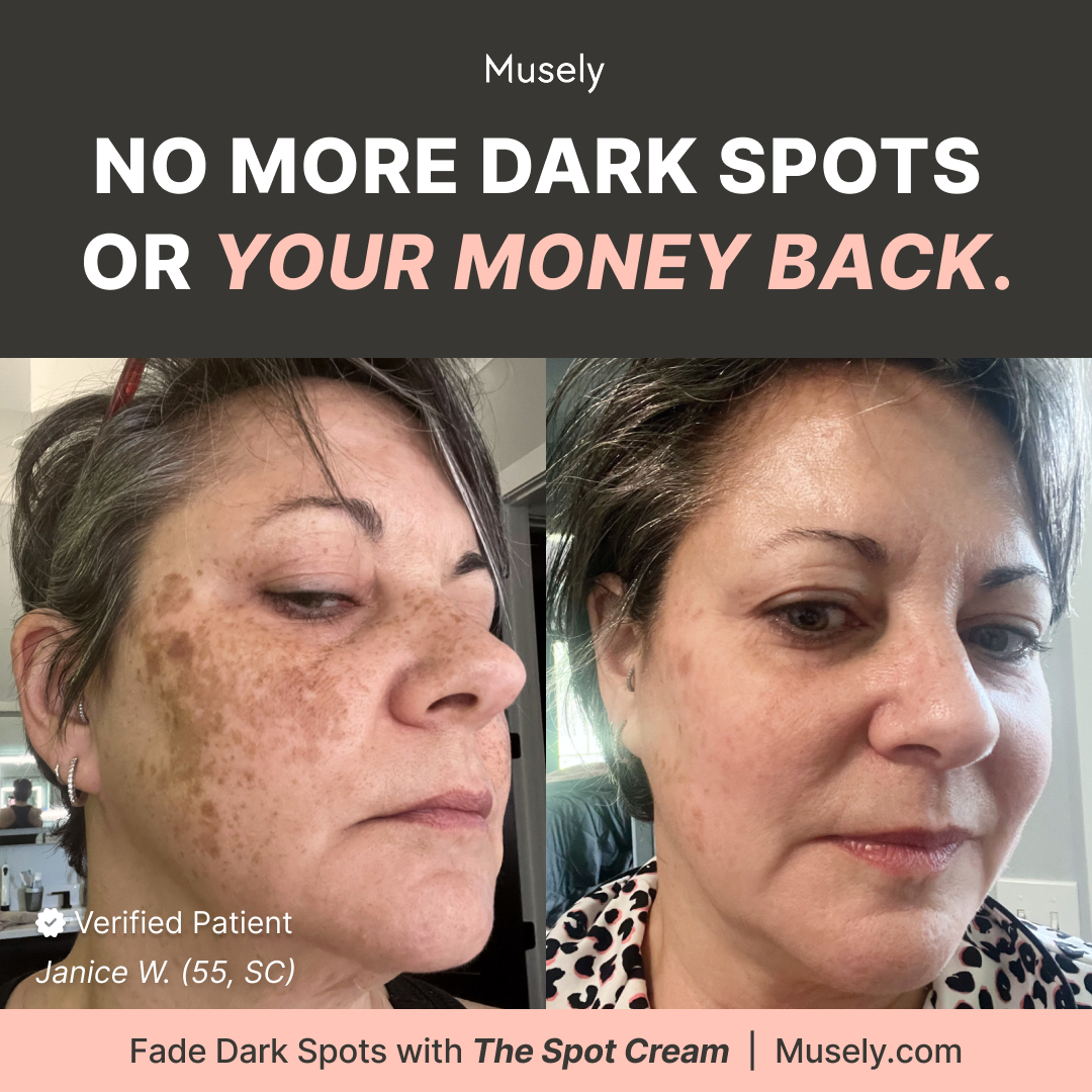 Musely FaceRx Facebook ad