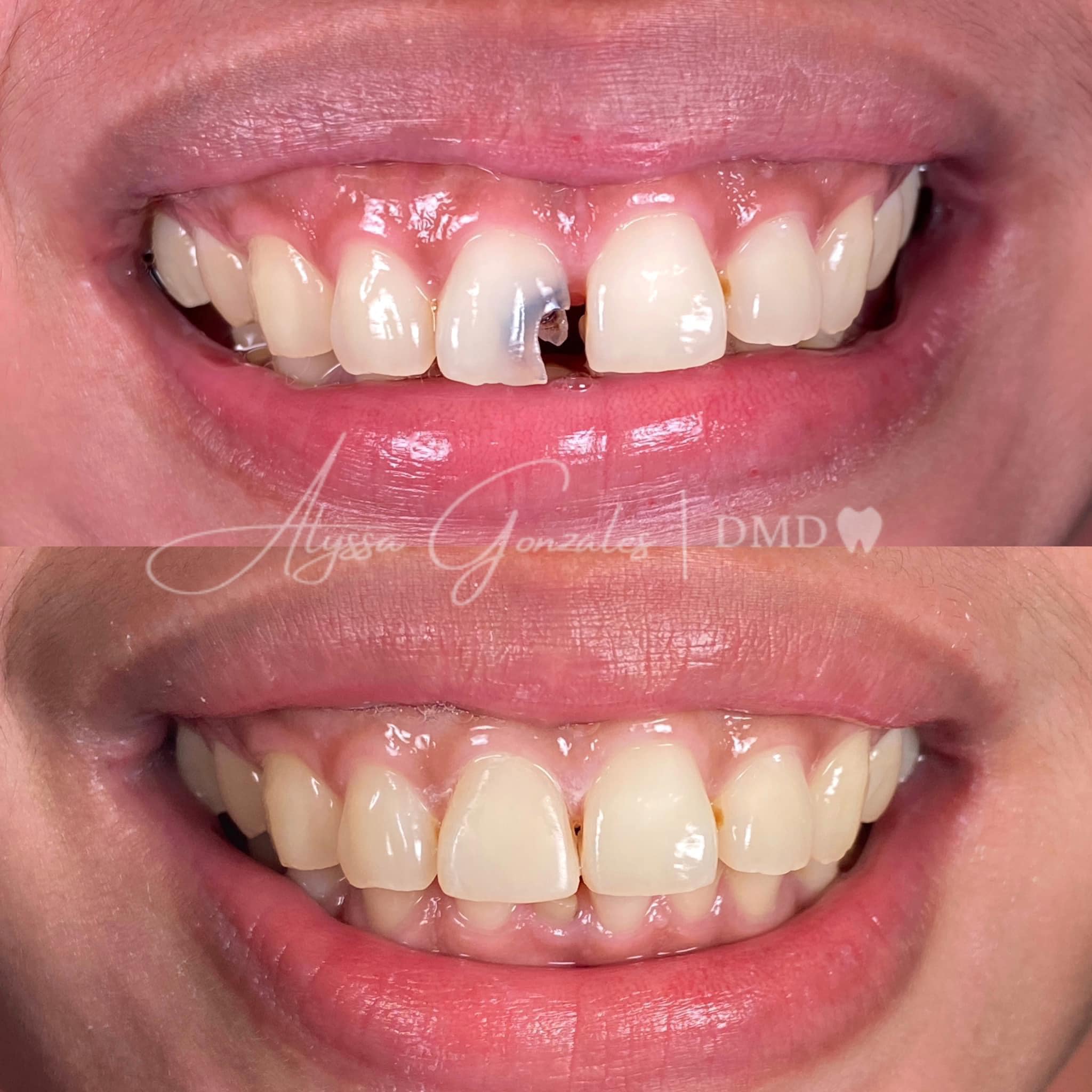 Gonzales Dental Clinic - Matina Facebook ad