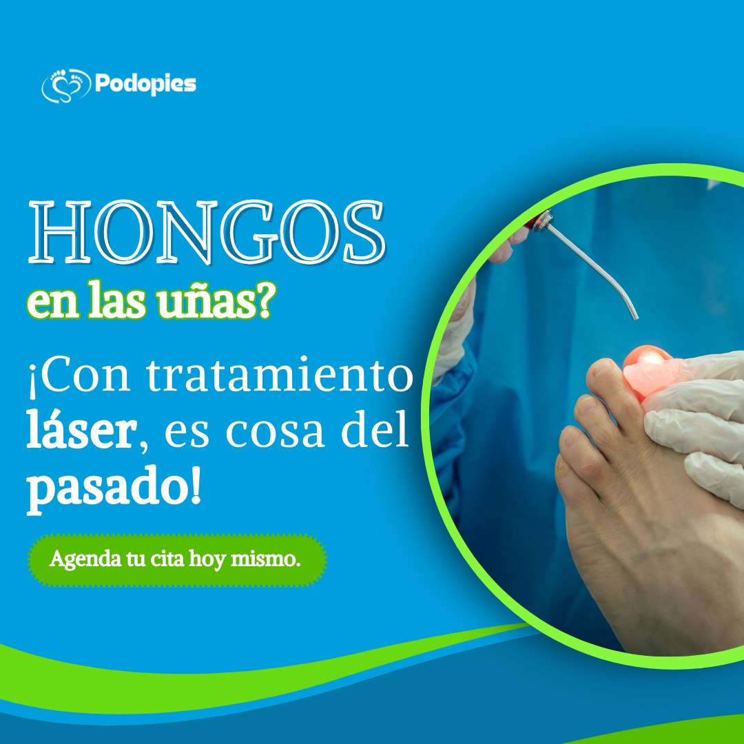PodoPies Chachapoyas Facebook ad