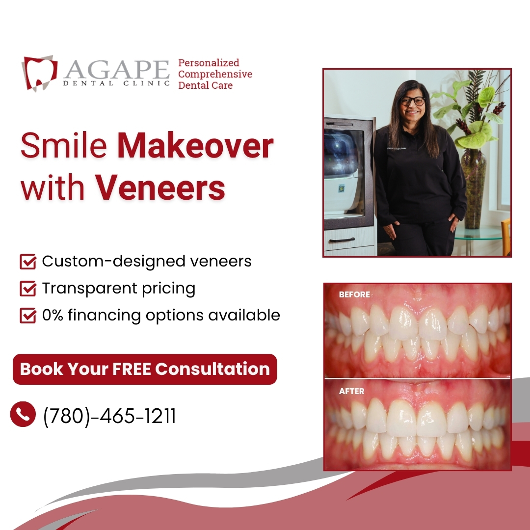 Agape Dental Clinic Millwoods Facebook ad