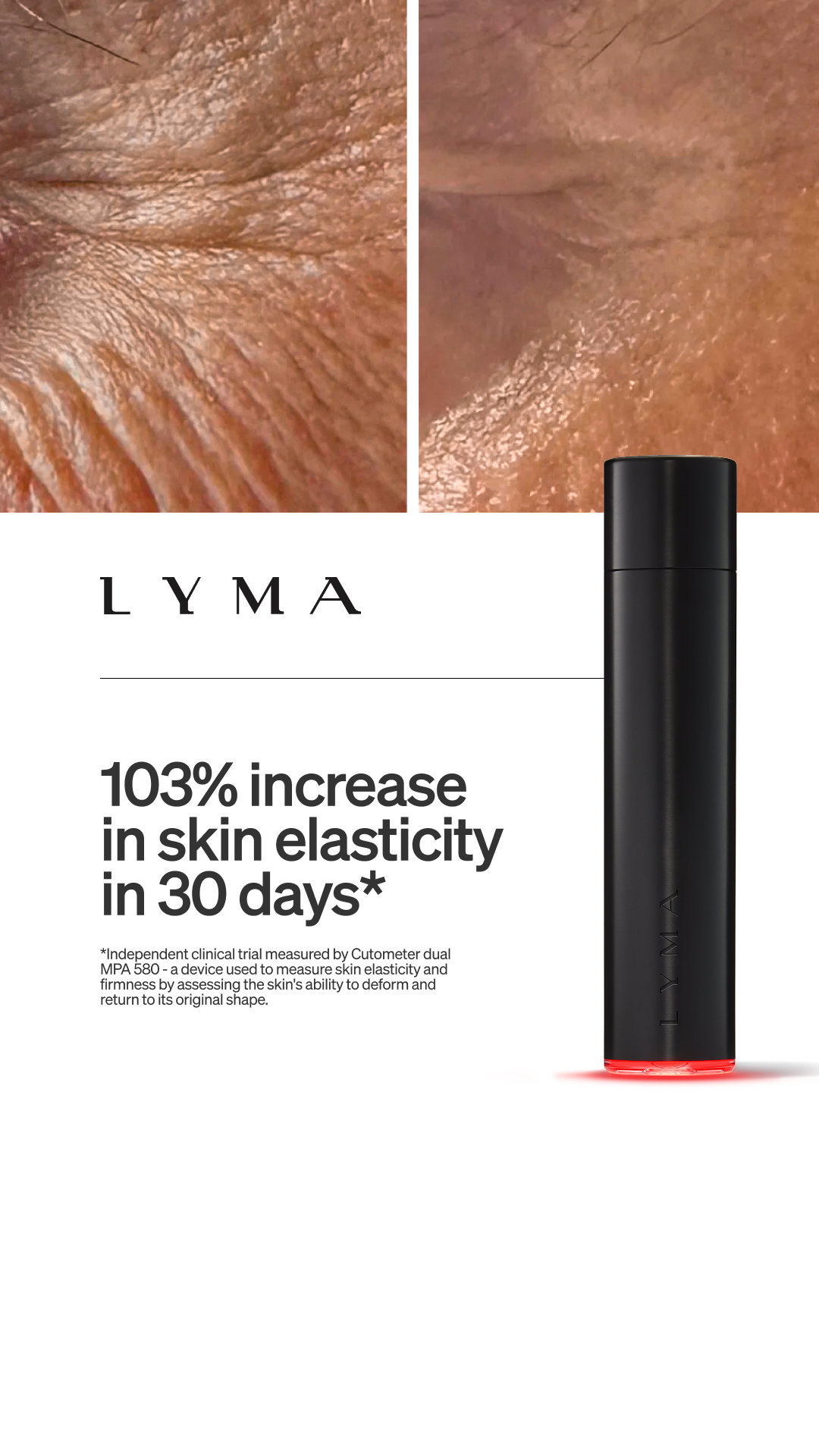 LYMA Facebook ad