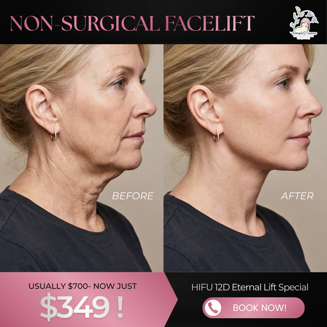 Tranquil Essence Skin Clinics Facebook ad from Feb 20, 2026
