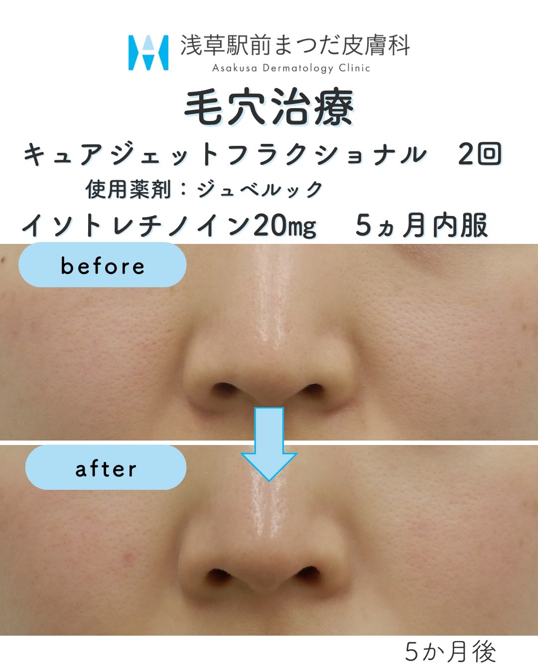 dr_matsuda_hiroki Facebook ad: 浅草駅前まつだ皮膚科の松田洋樹です