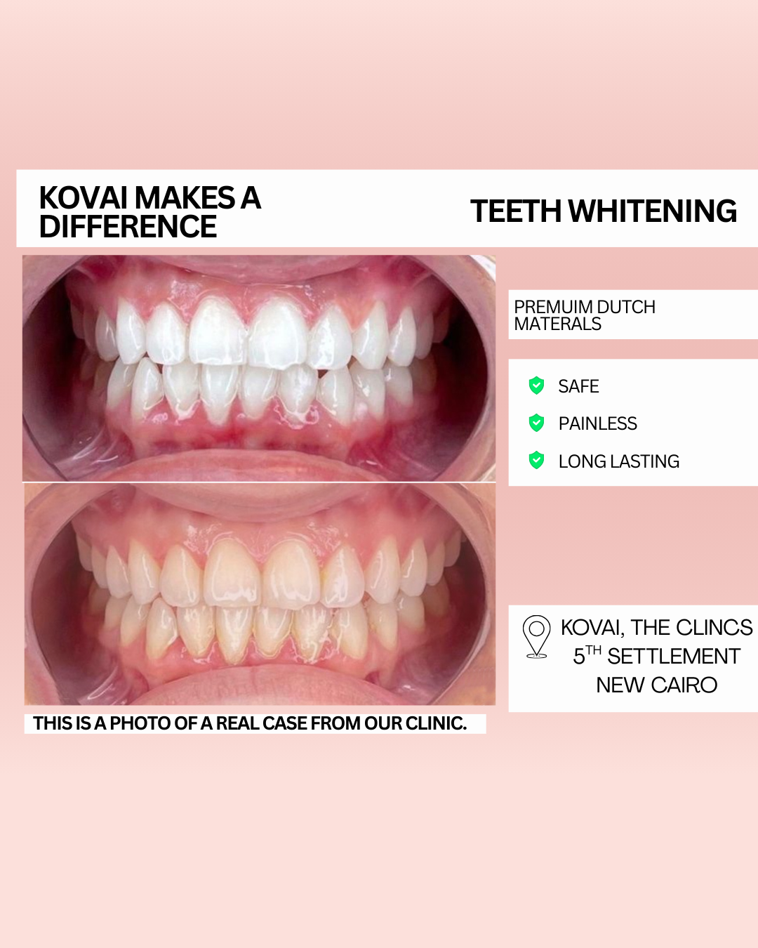 Kovai Dental Clinic Facebook ad: 999 EGP per session!