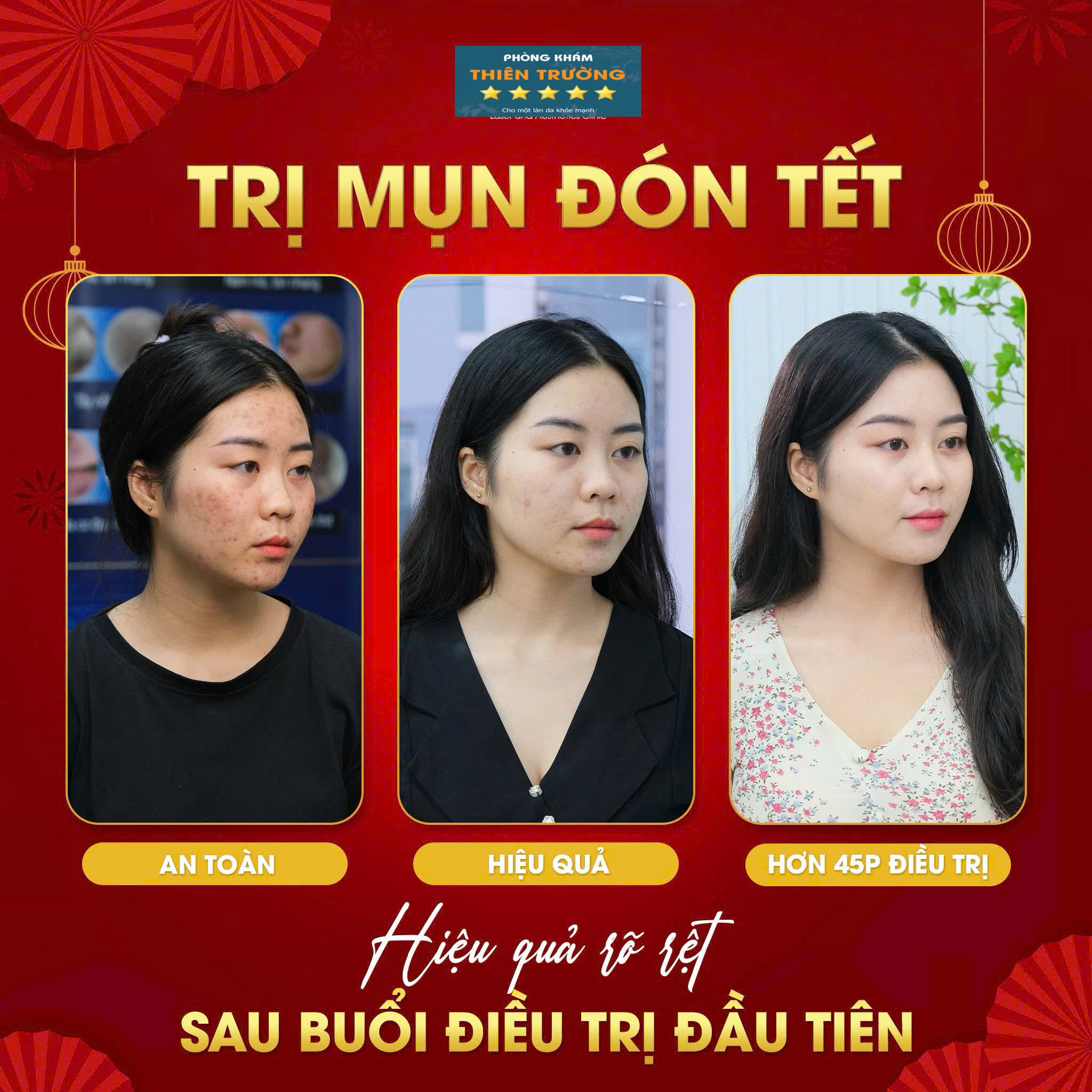Phòng khám Da liễu - Thẩm mỹ Thiên Trường Facebook ad