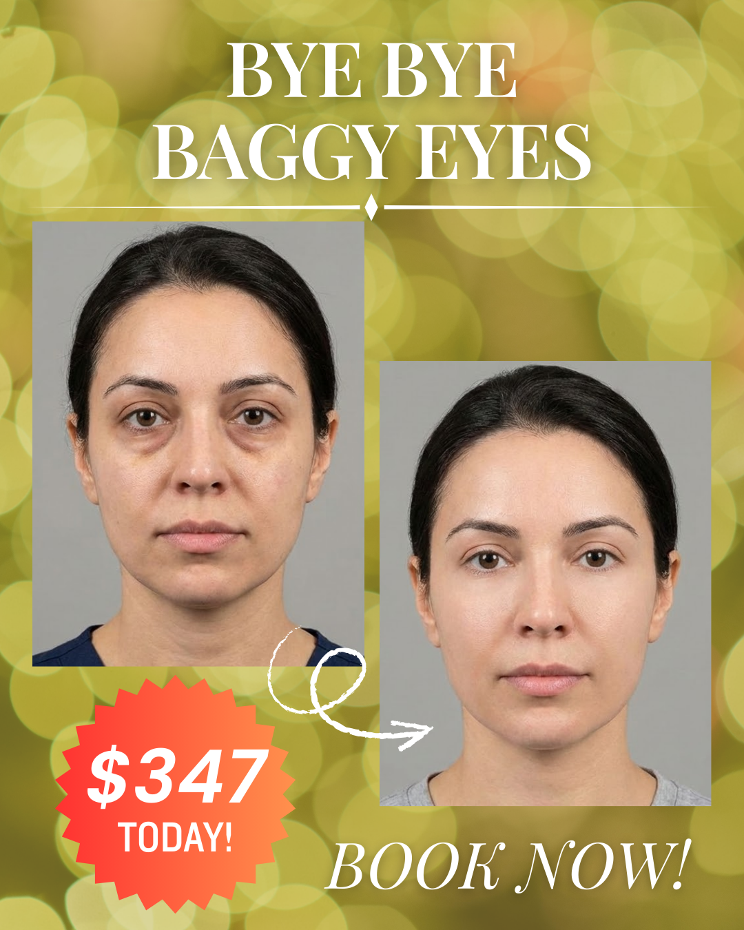 Park Ave Cosmetic Center Facebook ad: Get Our Bye Bye Baggy Eyes - JUST $347!
