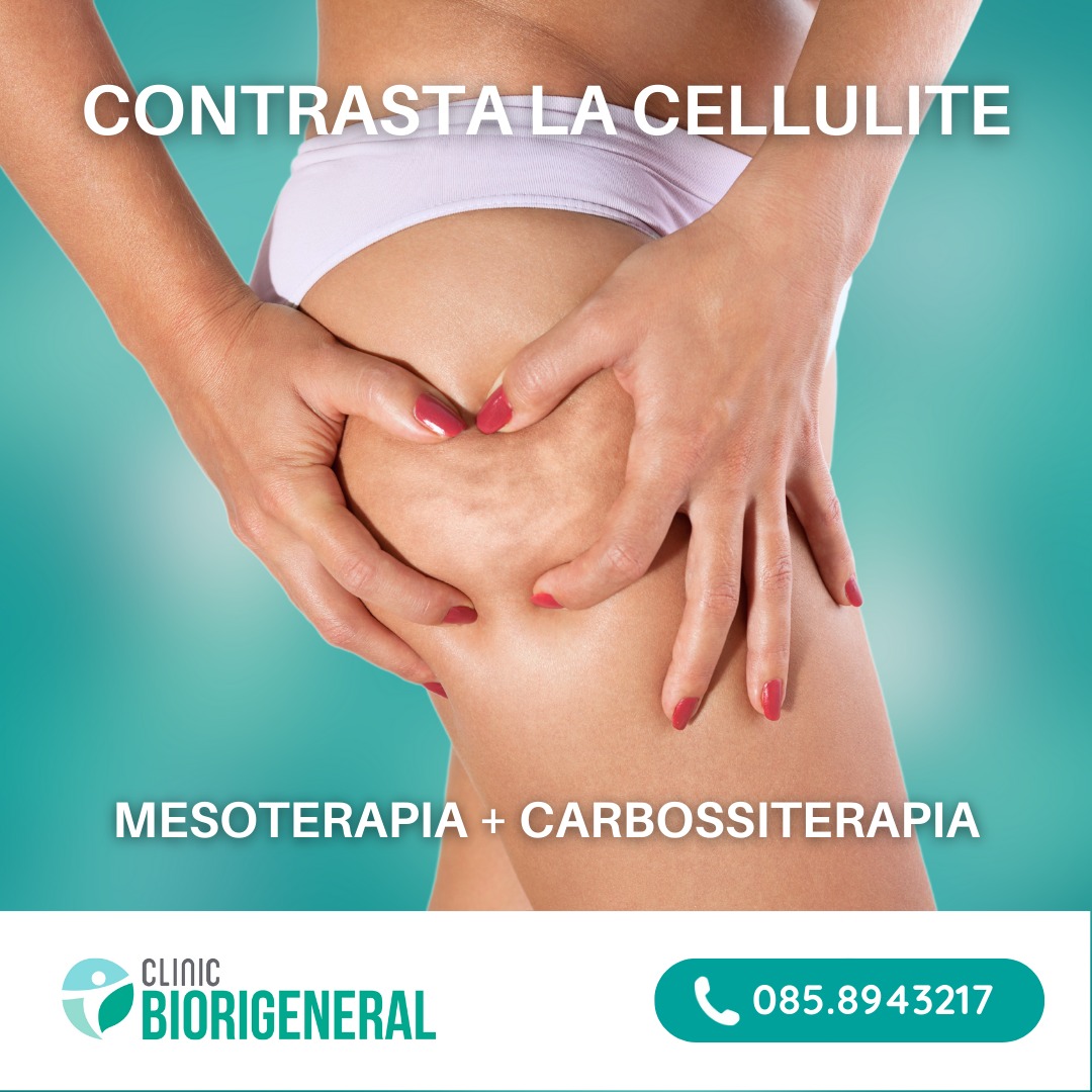 Clinic Biorigeneral Facebook ad: RITENZIONE IDRICA e CELLULITE?