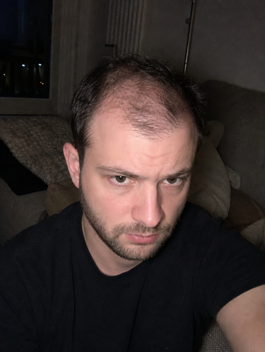 Dr. James Kreischer - Trichologist, MD Facebook ad