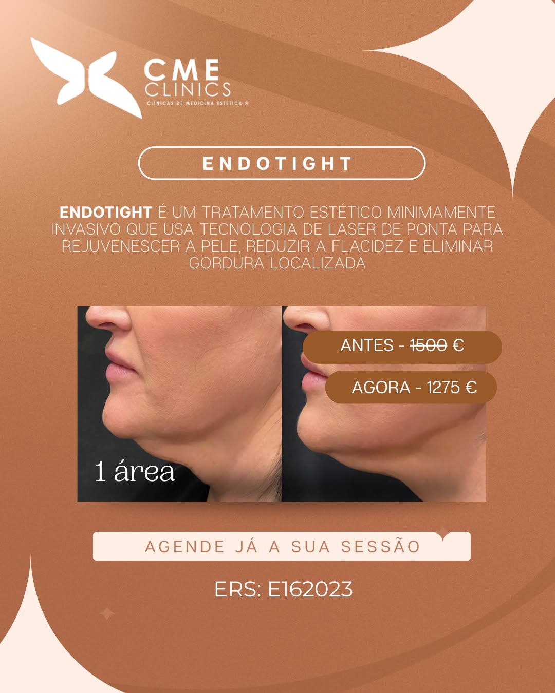 Guerra Rocha Facebook ad: CME Clinics | Clinicas de Medicina Estética, Cirurgia…