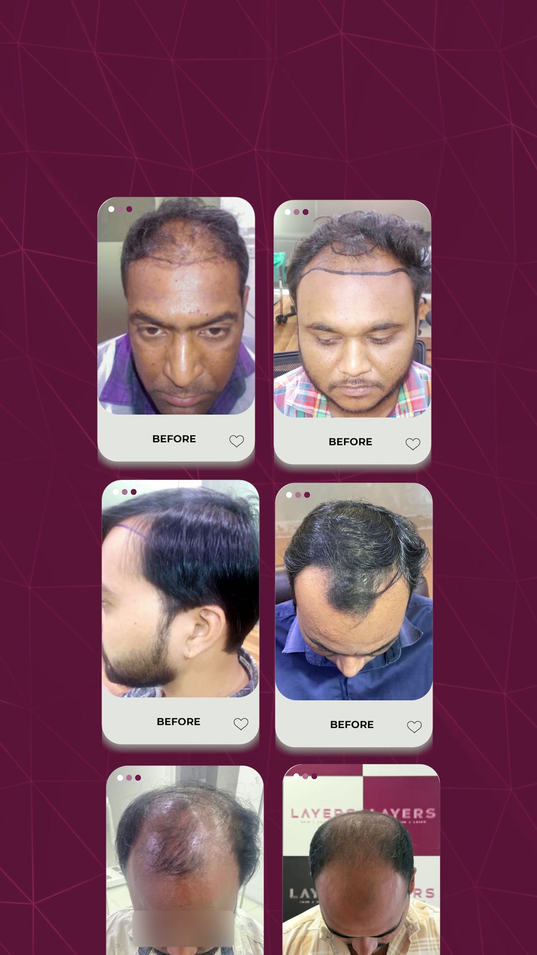Layers Clinics Facebook ad