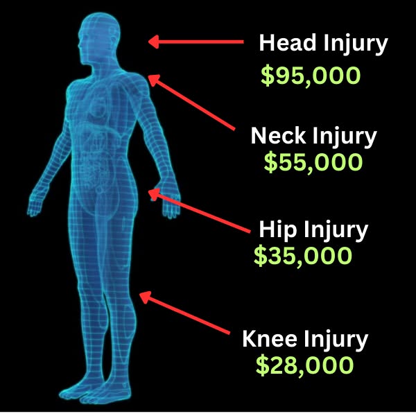 Accident Compensation Calculator Facebook ad: HUGE Cash Payout For Louisiana Drivers