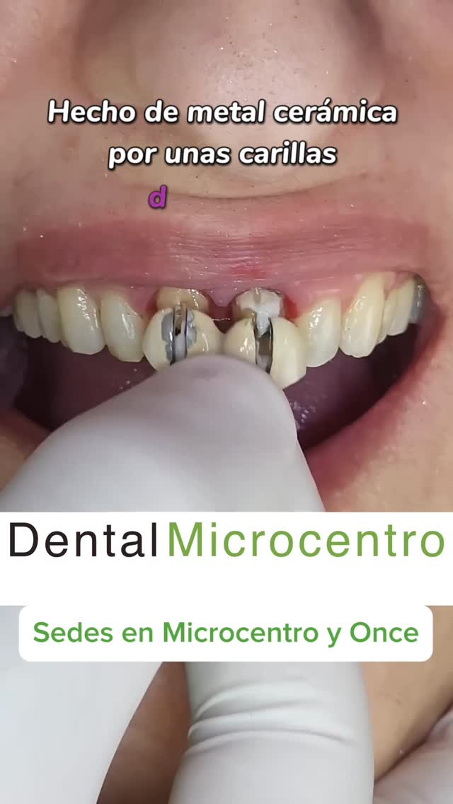 Dental Microcentro Facebook ad: Chatea con nosotros, Somos Dental Ciudad • Clínica…
