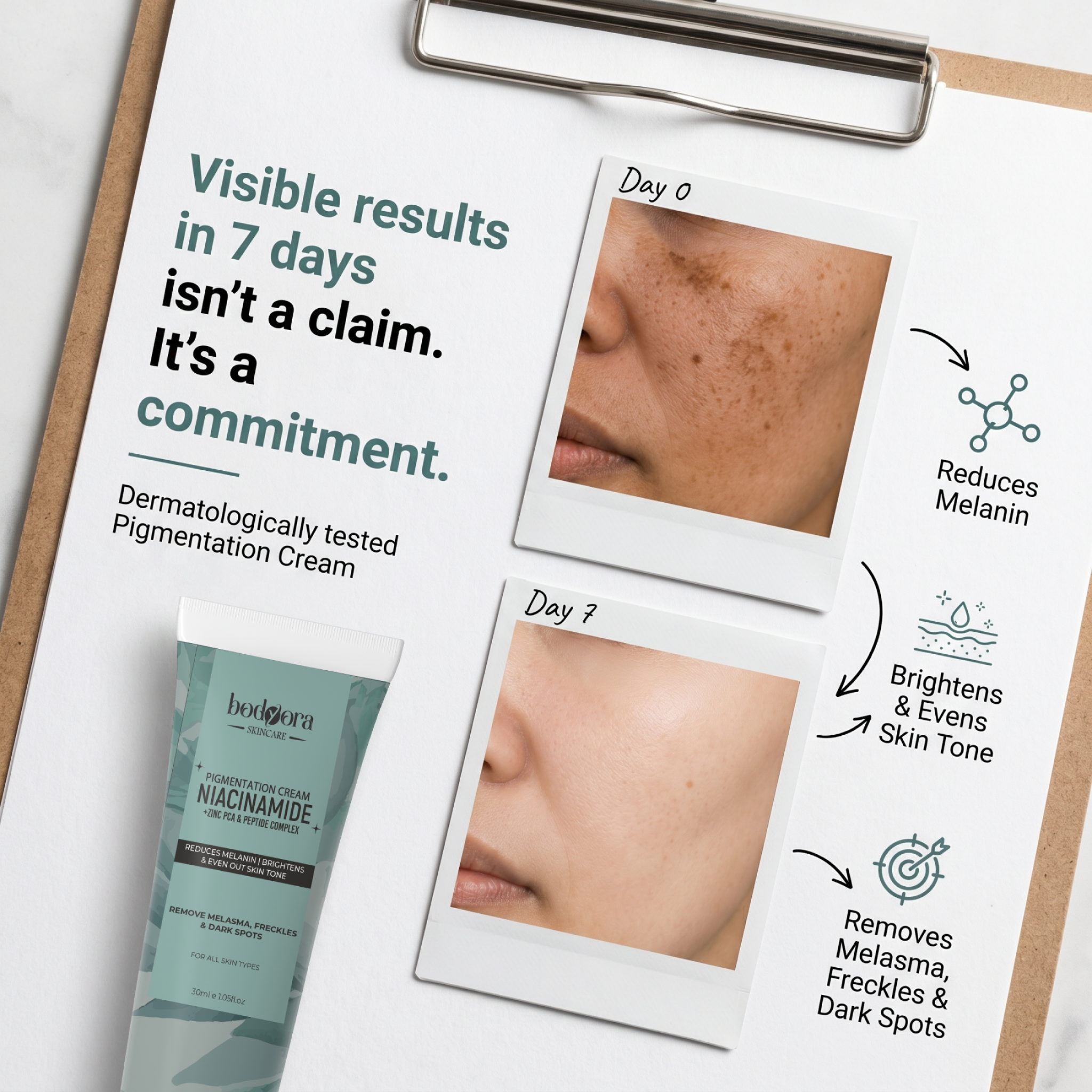 Bodyora Skincare Facebook ad: Best-Selling Pigmentation Cream
