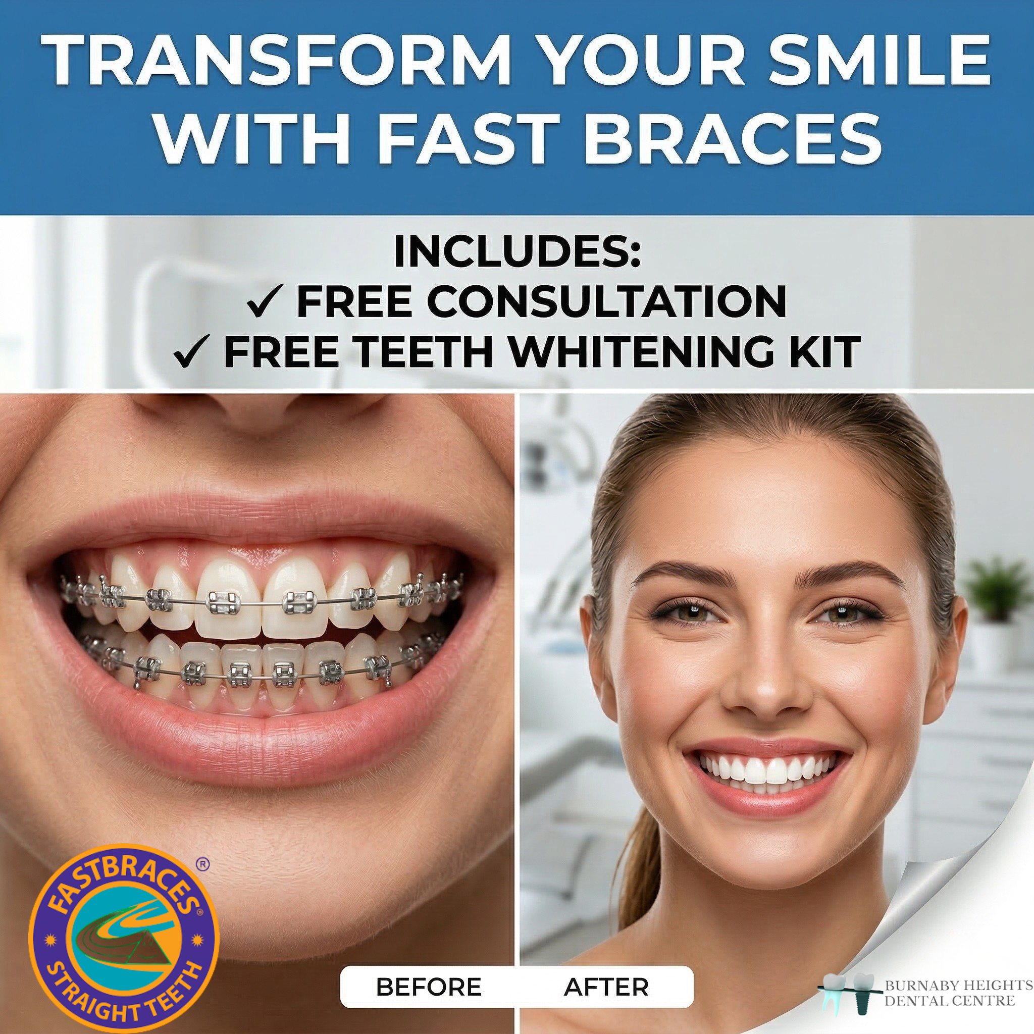 Burnaby Heights Dental Centre Facebook ad