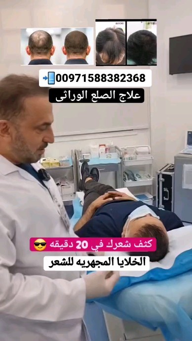 Al Manara Specialized Medical Center Facebook ad: بديل زراعة الشعر