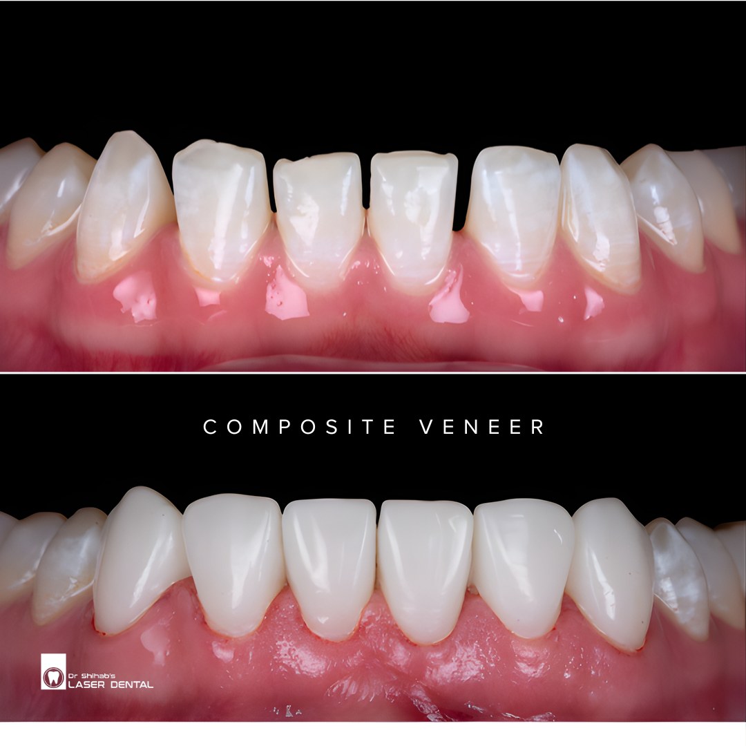 LASER DENTAL Facebook ad