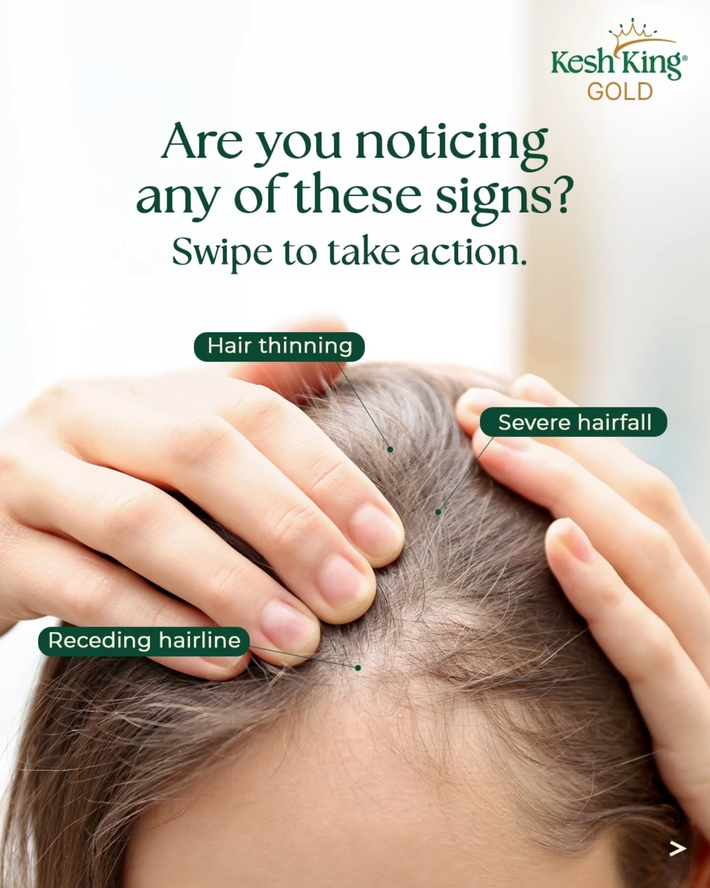 Kesh King Facebook ad: Let your hair tell a story of care…