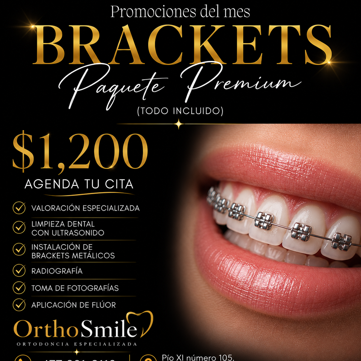 Orthosmile Facebook ad: INSTALACION DE BRACKETS X 1200$