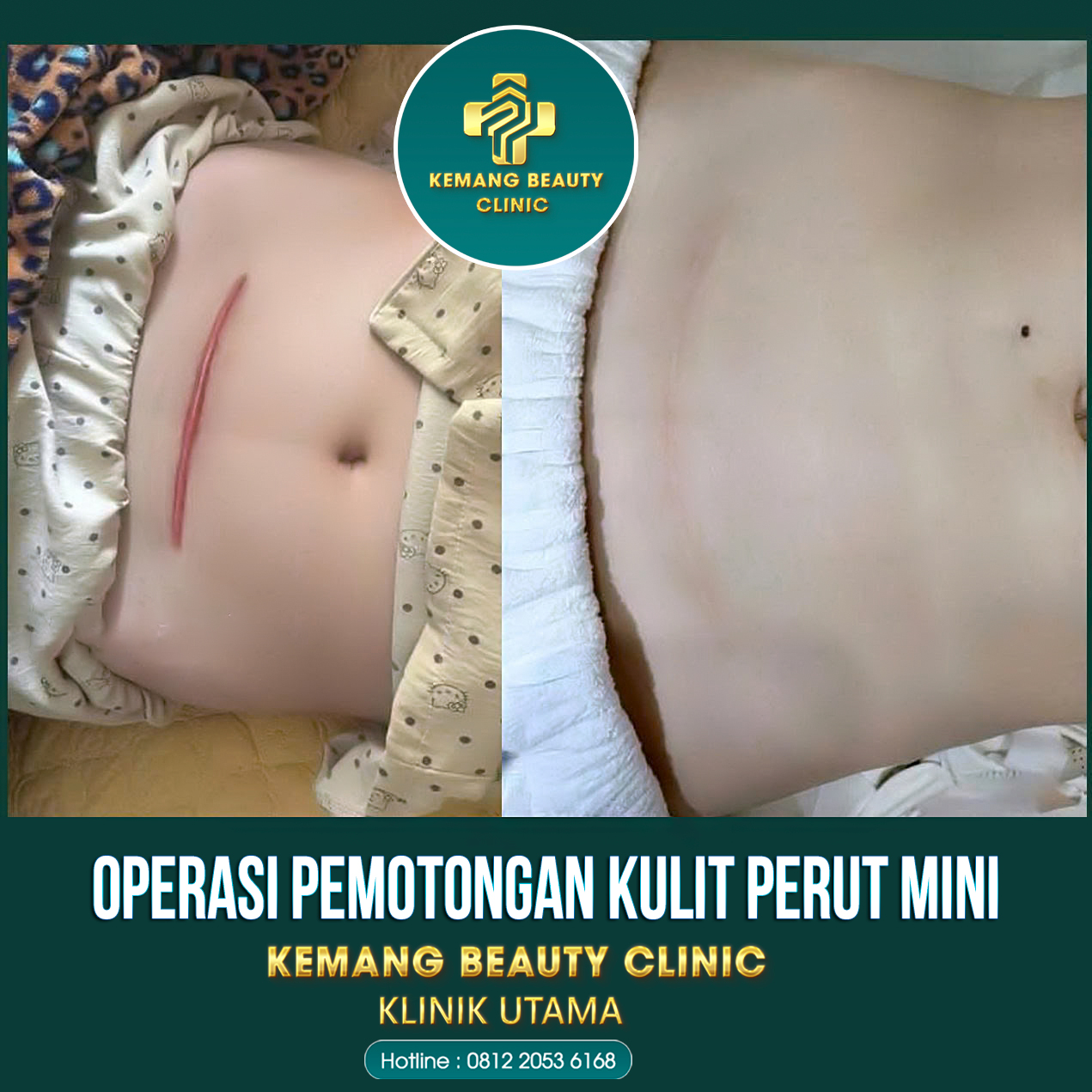 Kemang Beauty Clinic Facebook ad