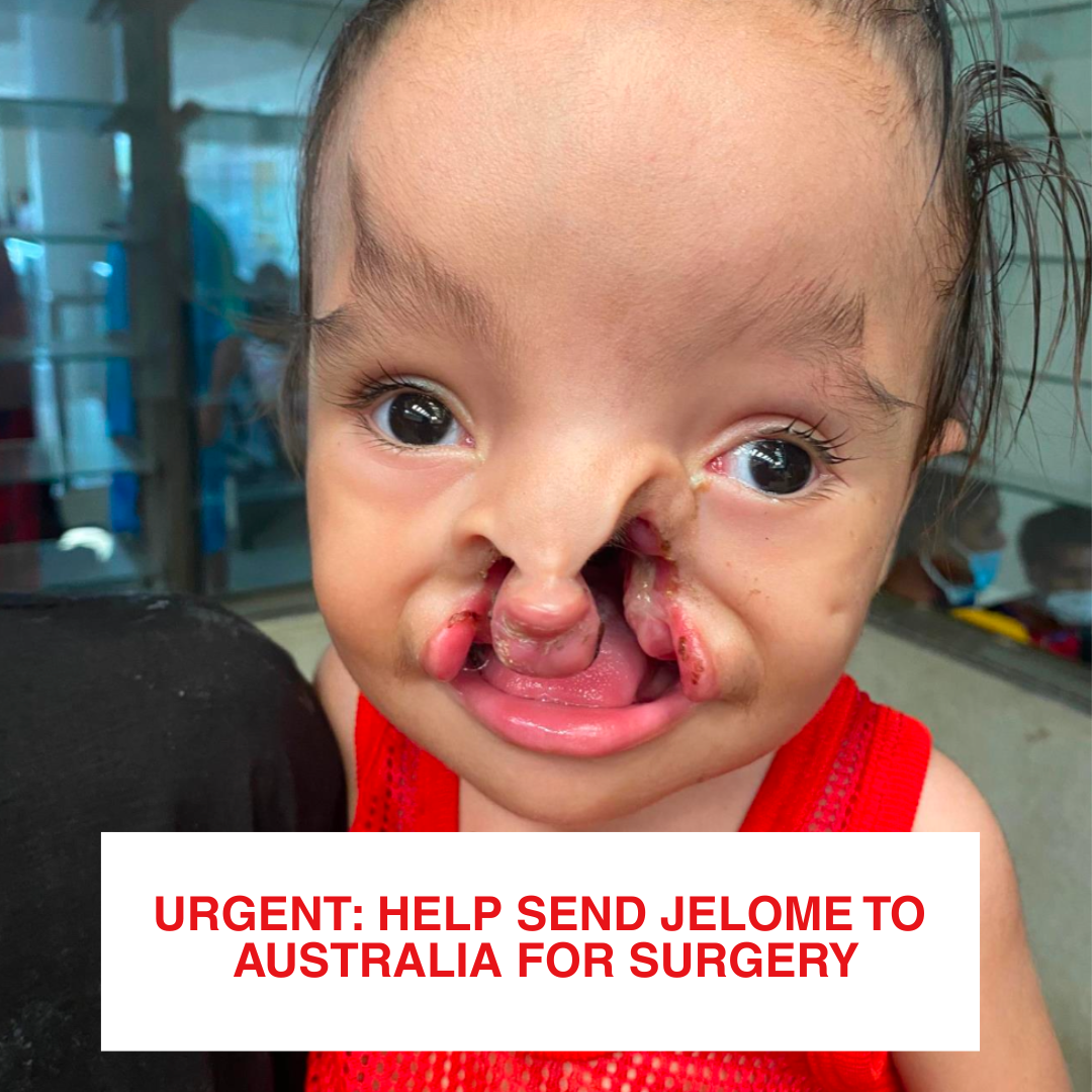 Children First Foundation Facebook ad: Help him now