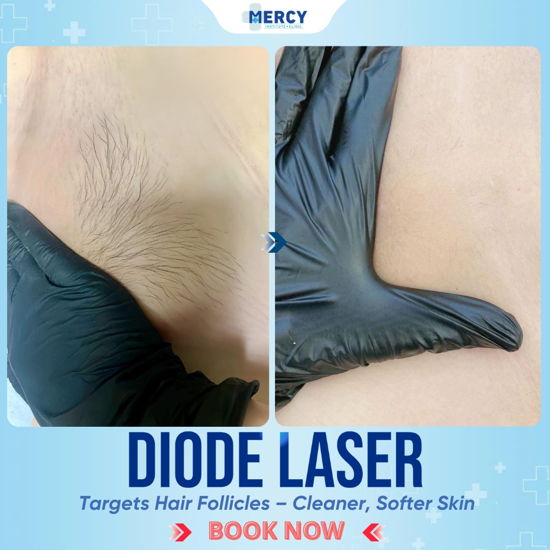Mercy Clinic Davao Facebook ad