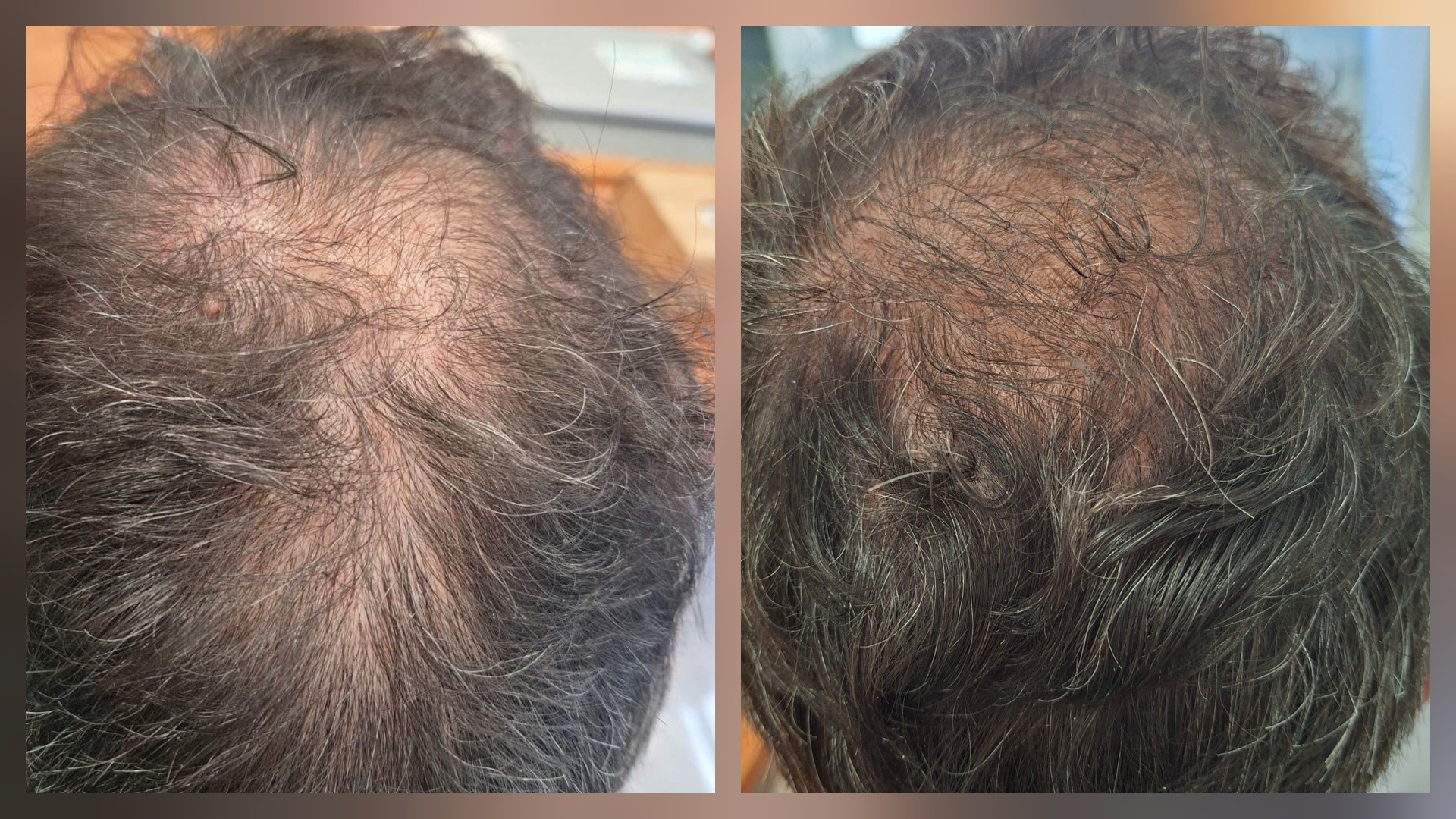 BIOHAIR Clinic Facebook ad: Εντυπωσιακή βελτίωση της ποιότητας της τρίχας!