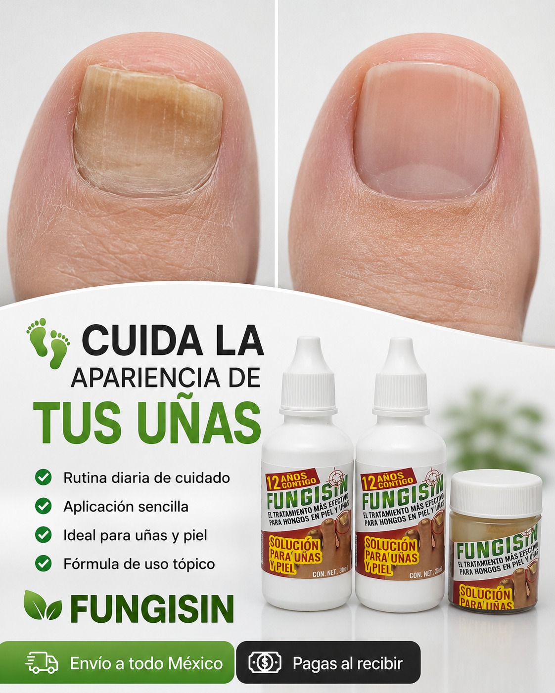 Distribuidora Natural Santa Anna Facebook ad: ¿EL MAL OLOR EN TUS PIES NO SE…